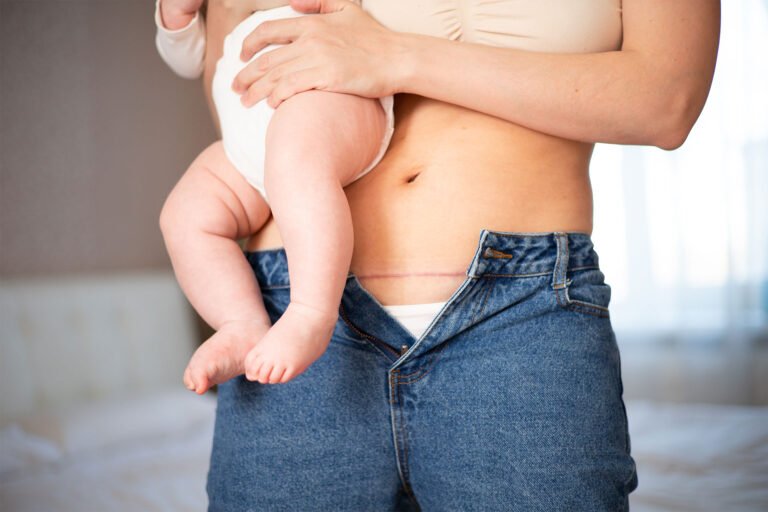 Read more about the article Postpartum Weight Loss: Reclaiming Mother Body After Birth